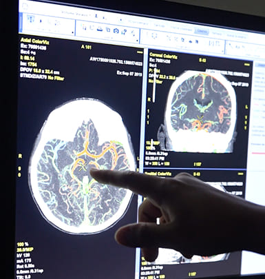 TOMOGRAFIA COMPUTARIZADA 3