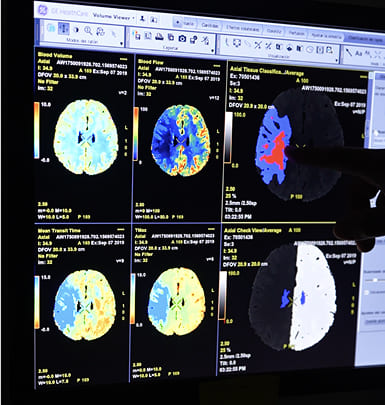 TOMOGRAFIA COMPUTARIZADA 4