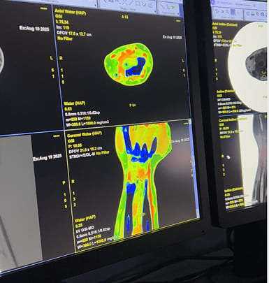 TOMOGRAFIA COMPUTARIZADA 5