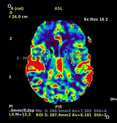 resonancia magnetica 2