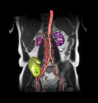 resonancia magnetica 3